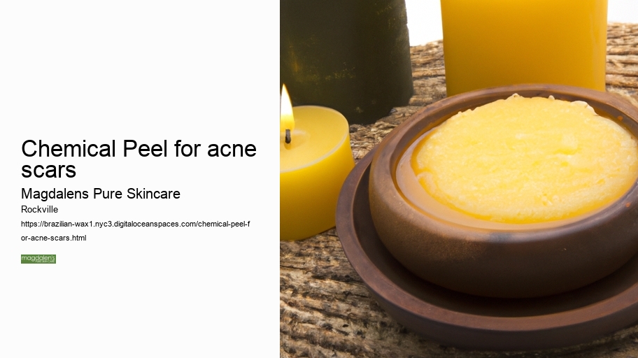 Chemical Peel for acne scars
